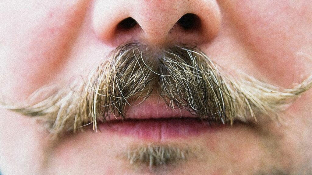 sakal ekimi bıyık ekimi antalya